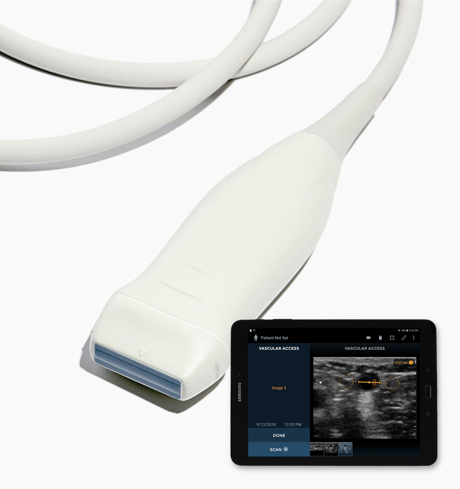 November 2018 Update 04 Vein